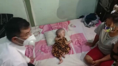 Wabup Erwan Kunjungi Penderita Hydrocephalus