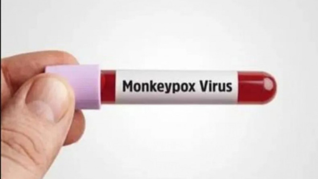 Kemenkes Sebut Satu Pasien Cacar Monyet di Tanah Air Sudah Sembuh