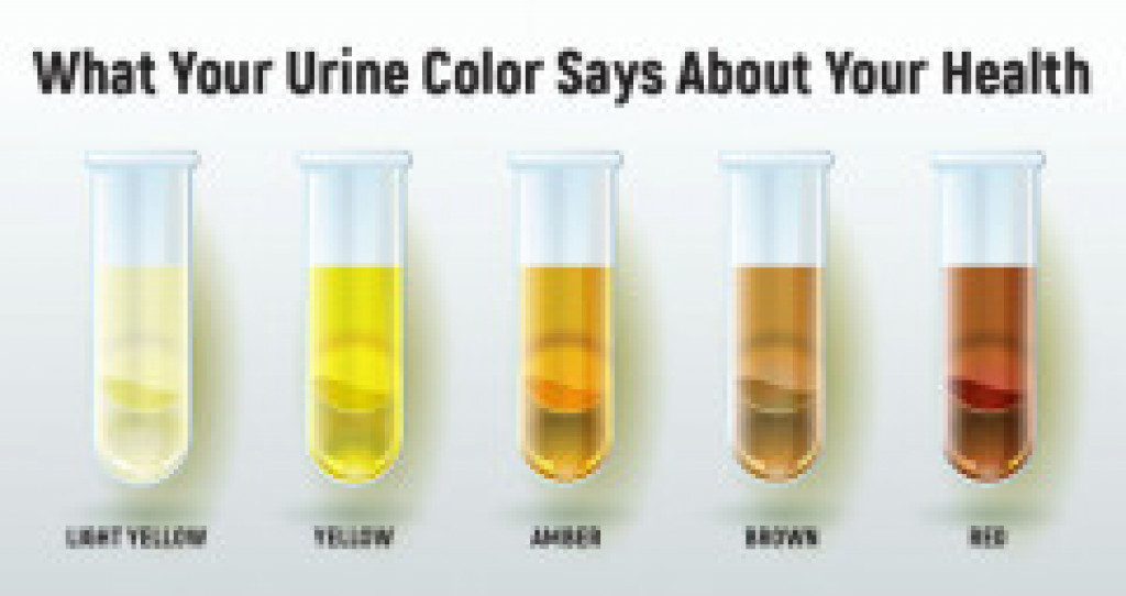 Ungkap Kondisi Kesehatan Anda, Ini 11 Warna Urine dan Artinya