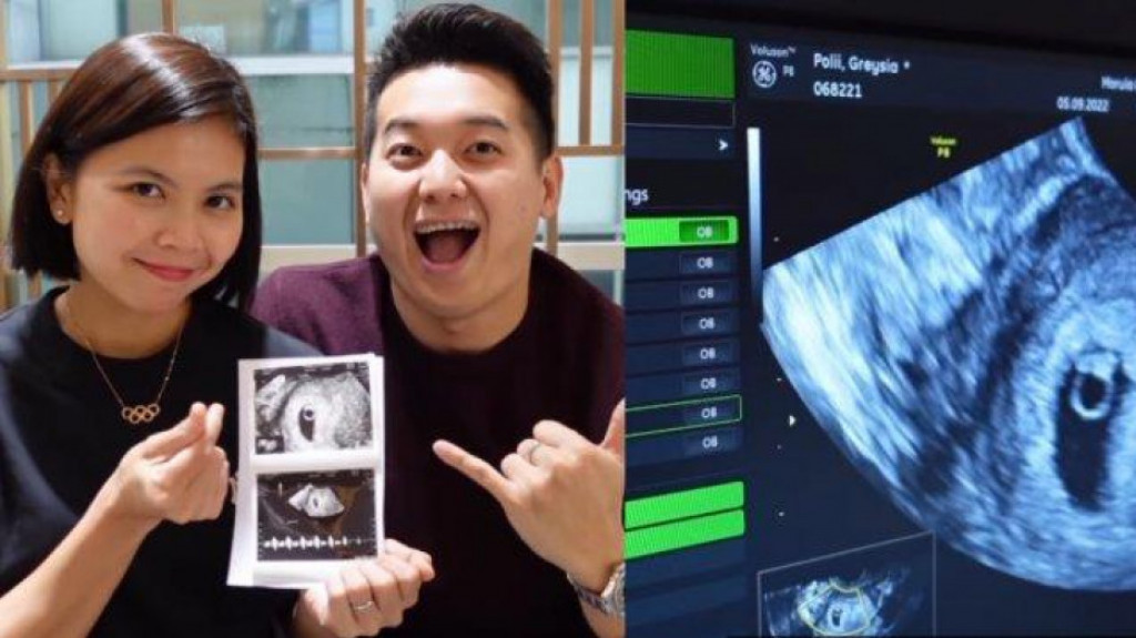 Hamil Anak Pertama, Greysia Polii Dapat Ucapan Selamat dari Pebulutangkis Dunia