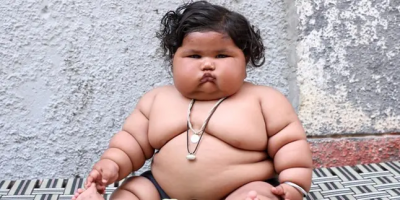 Dampak Buruk Obestitas Pada Bayi, Jangan Dibiarkan!