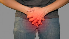 Fakta-fakta Wanita Sibolga yang Potong Kelamin Selingkuhannya hingga Nyaris Putus